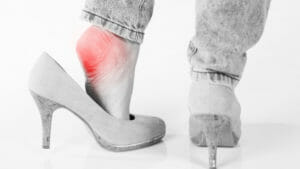 Read more about the article Punya Masalah Tumit Lecet Karena Sepatu? 10 Ini Tips Mencegah dan Sekaligus Mengatasinya